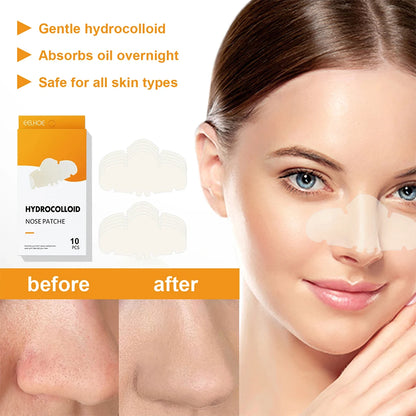 Hydrocolloid nose patches
